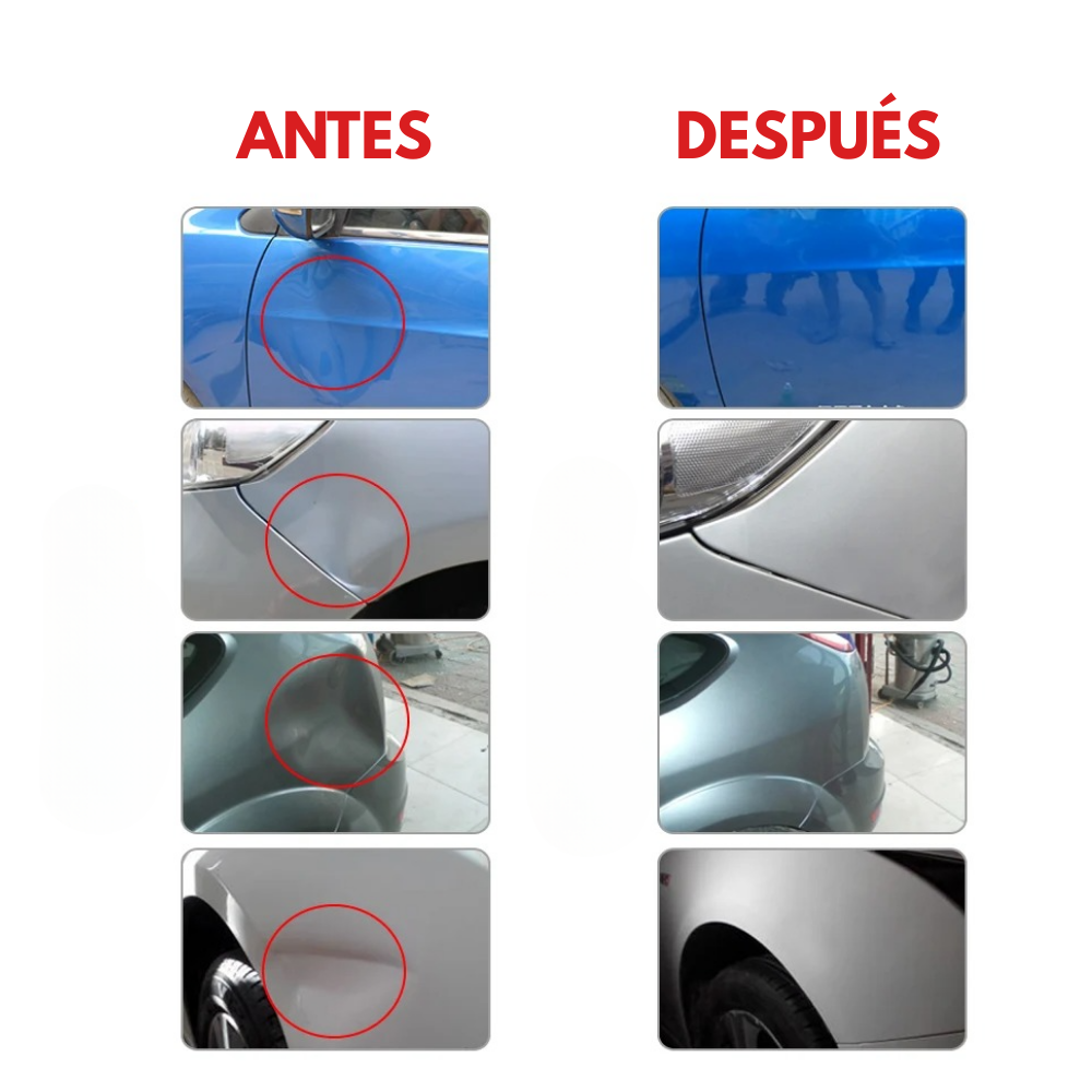 Ventosa Multifuncional